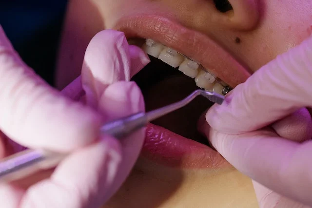 adult-orthodontics